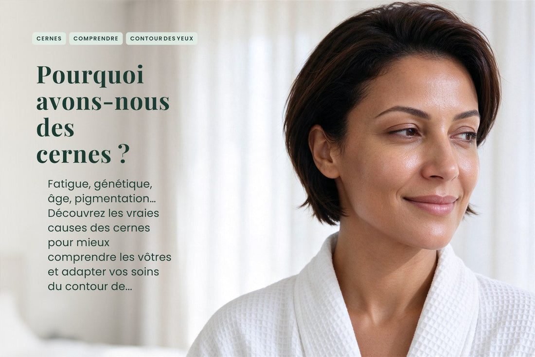 Pourquoi avons-nous des cernes ?